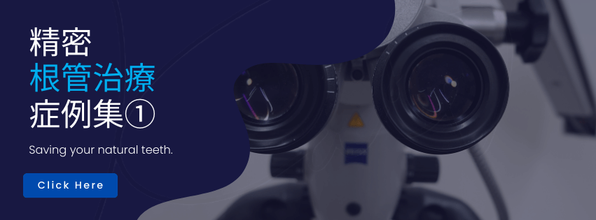 精密根管治療症例集① 詳しくはこちら
